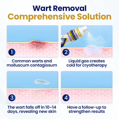 🔥 ONIY 3 HOUR 50% OFF 🔥 ChillErase Bump Renewal Spray🔥