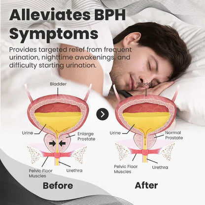 🎁 Official Brand Store Last Day Sale: Buy 1 Get 1 Free 🎇 CopperMag Prostate Ring 🌟